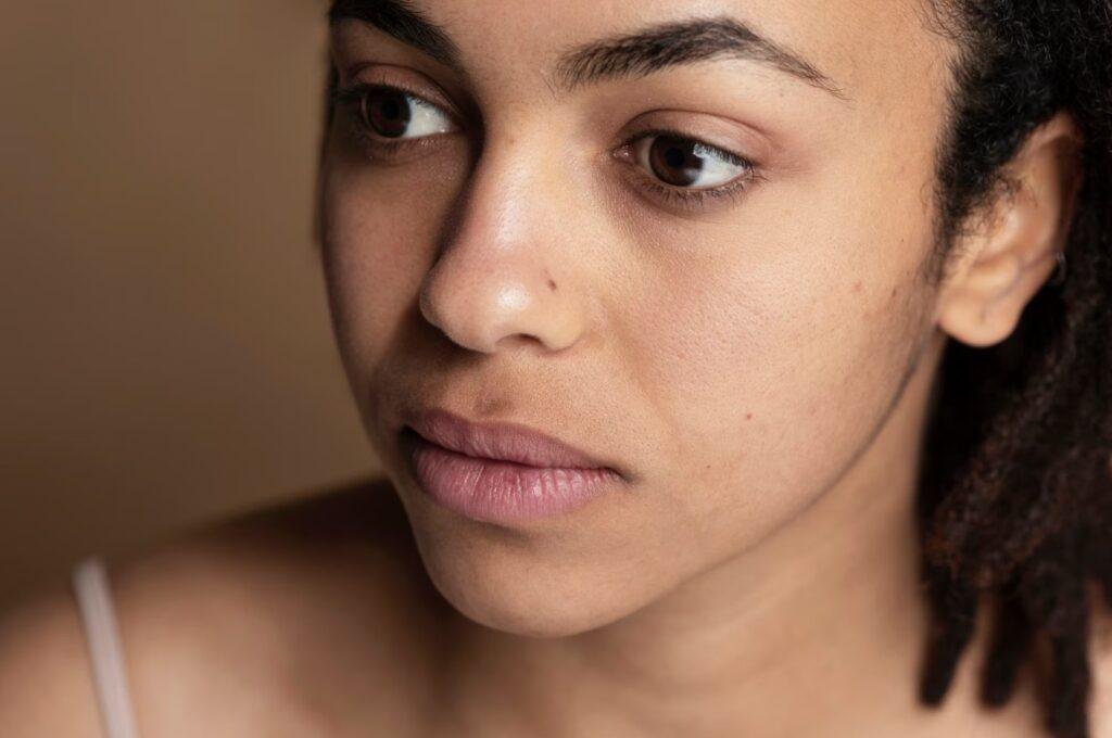 how to get rid of uneven skin tone on face naturally